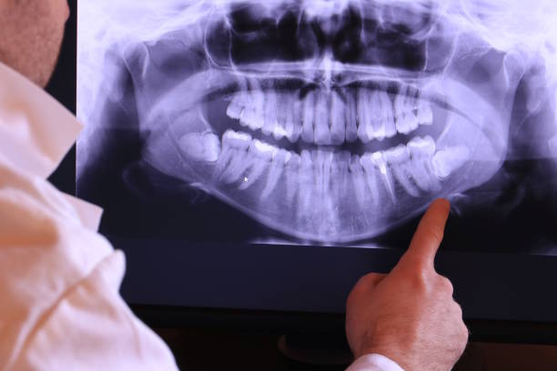 Best Emergency Gum Treatment in Jean Fitte, LA